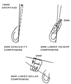 Manual Illustration